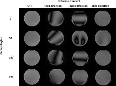 Tuning the optimal diffusion-weighted MRI parameters on a 0.35-T MR-Linac for clinical implementation: A phantom study